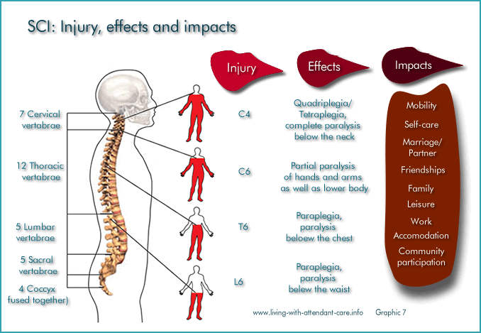 Graphic 7:
SCI: Injury, effects and impacts